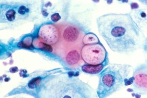 Clamydia Tracomatis, batterio responsabile della Clamidia